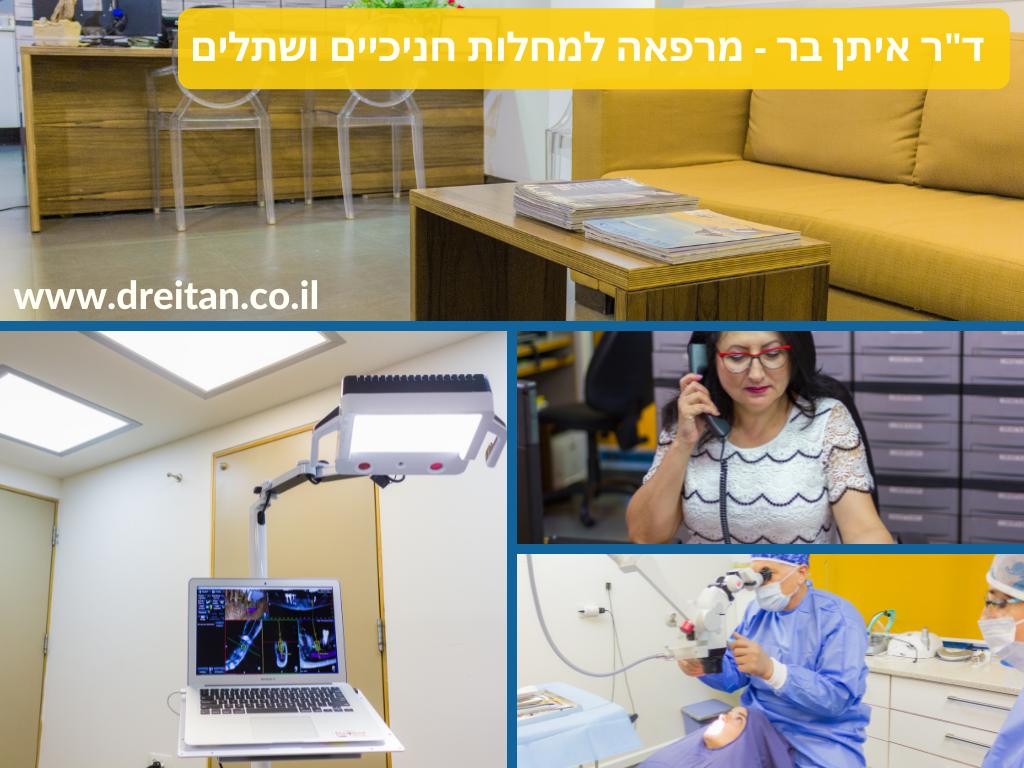 השתלת שיניים בבאר שבע